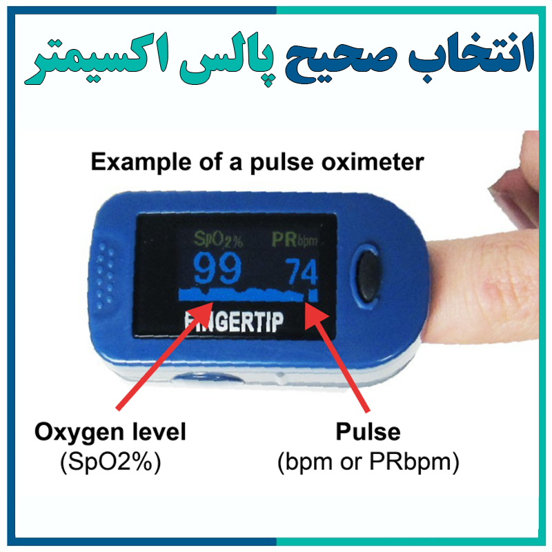 پالس اکسیمتر: هدف، کاربردها و نحوه خواندن